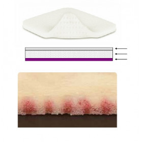 Medicazione Assorbente In Schiuma Di Poliuretano Mepilex Xt Con Strato Di Contatto In Silicone 10 X 10 5 Pezzi