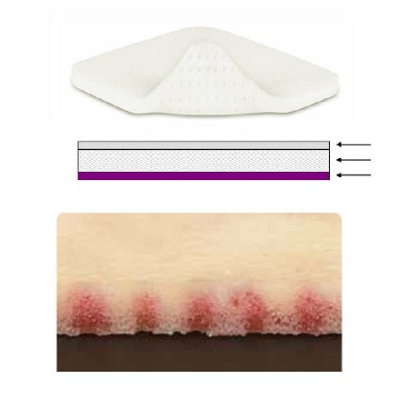 Medicazione Assorbente In Schiuma Di Poliuretano Mepilex Xt Con Strato Di Contatto In Silicone 5 X 5 5 Pezzi